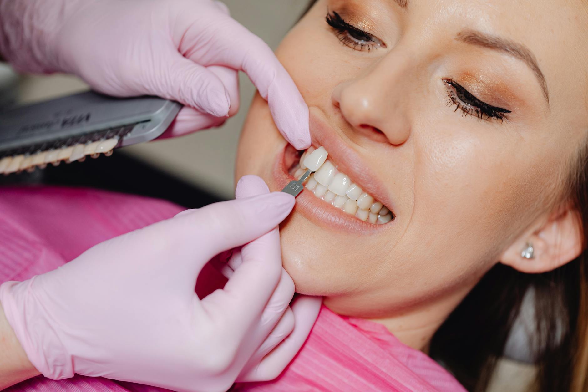 Close-up of a porcelain veneer being placed during a cosmetic dental procedure