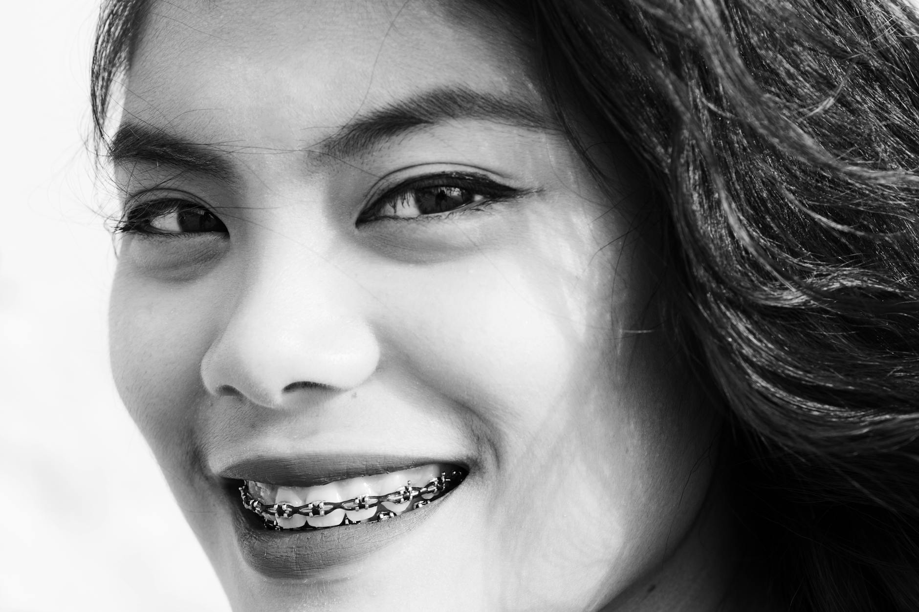 Smiling woman with metal braces, black and white close portrait