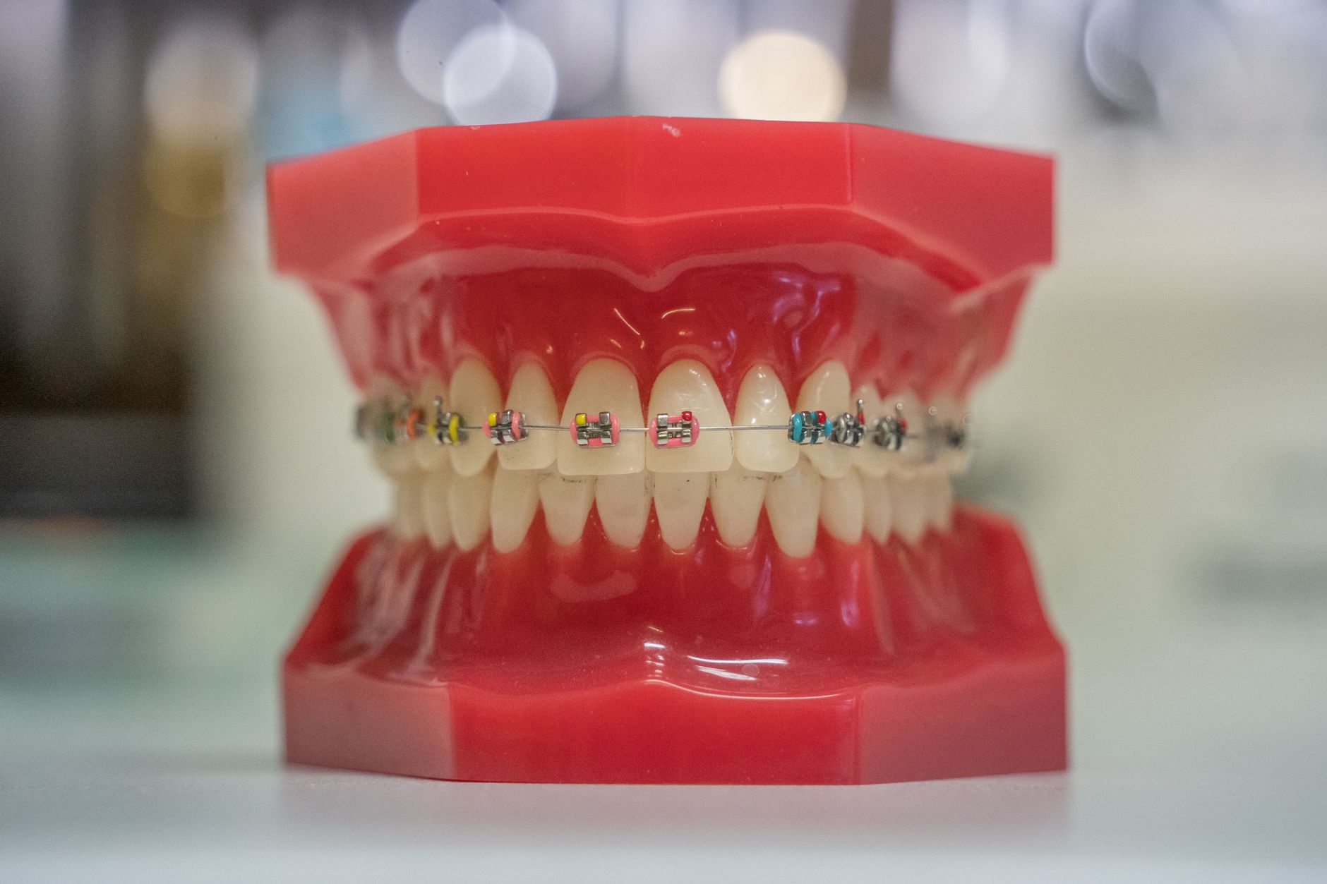 Dental model showing colorful braces brackets on upper and lower teeth
