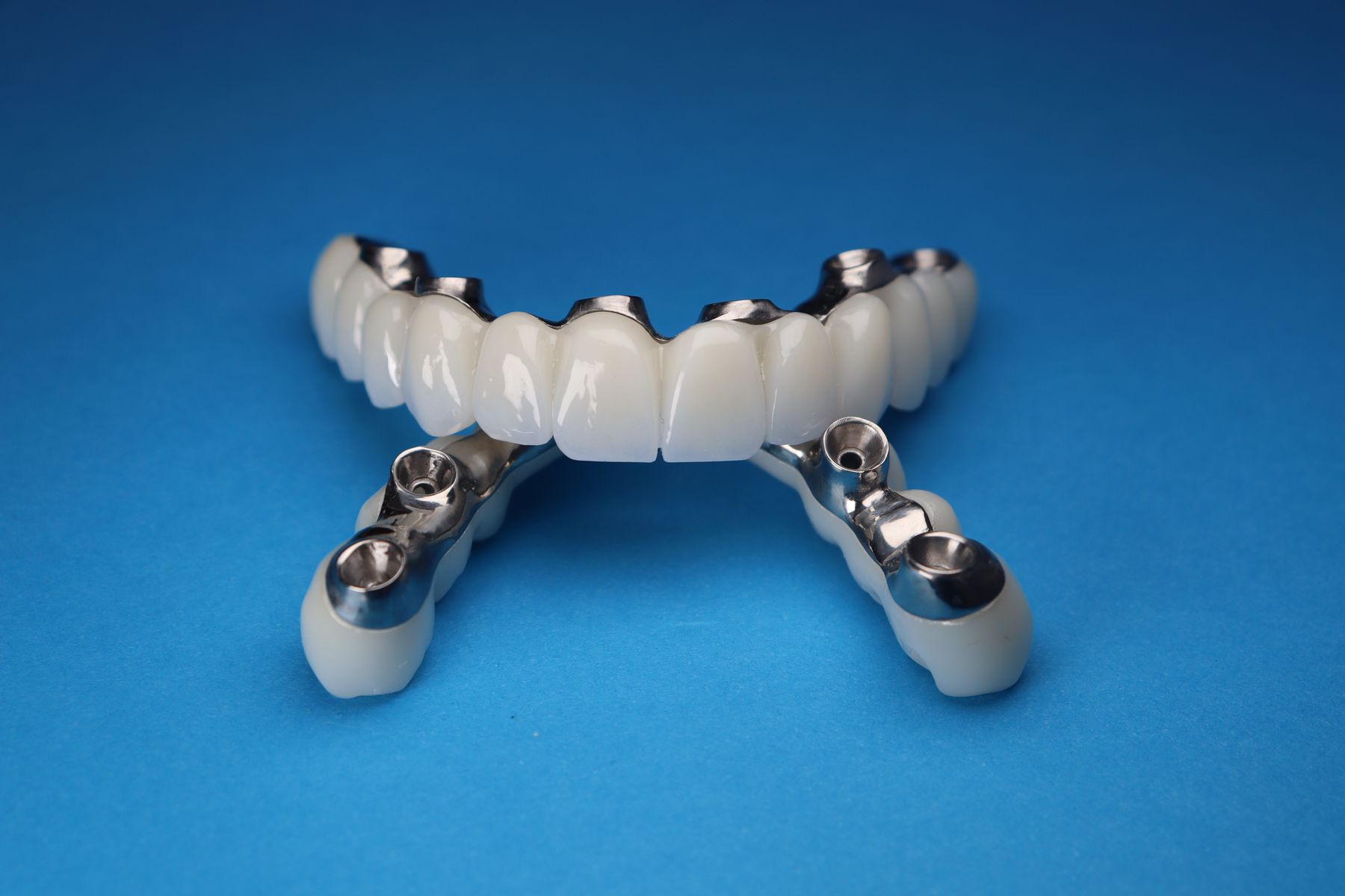 Close-up of a dental implant prosthetic model