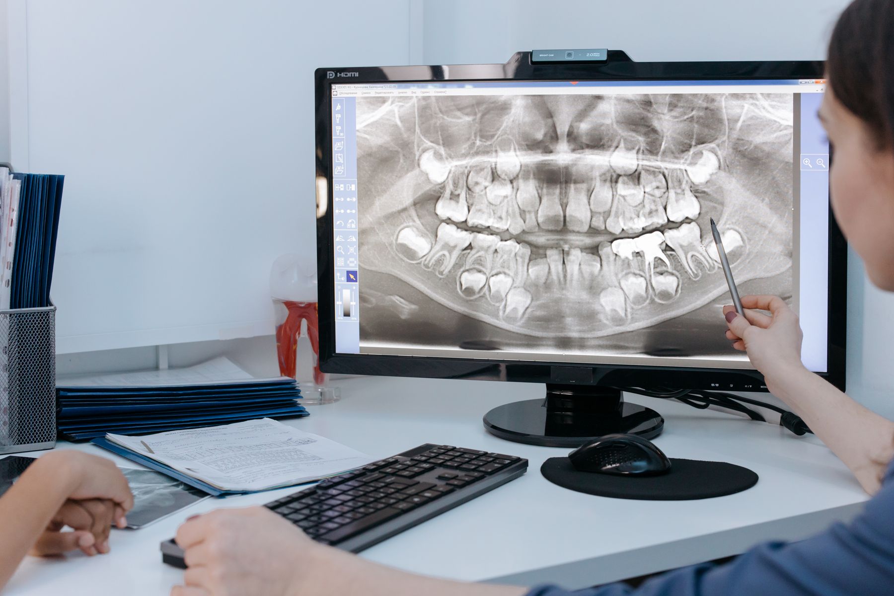 Oral surgeon reviewing a patient X-ray on a computer screen
